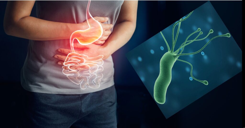 Helicobacter pylori síntomas y tratamiento DiagNosis