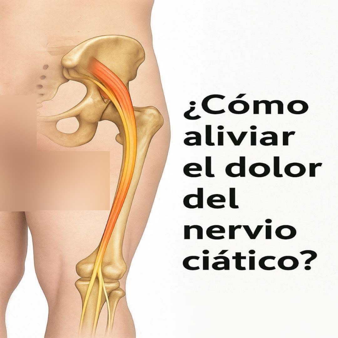 Ilustración del cuerpo humano que muestra el nervio ciático