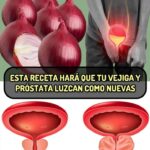 Mejora la Salud de Tu Vejiga y Próstata con la Cebolla y Sus Cáscaras