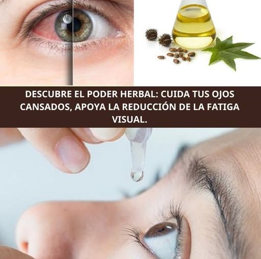 Remedio Natural para el Cuidado de los Ojos