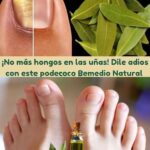 Dile Adiós a los Hongos en las Uñas con Este Poderoso Remedio Natural de Laurel